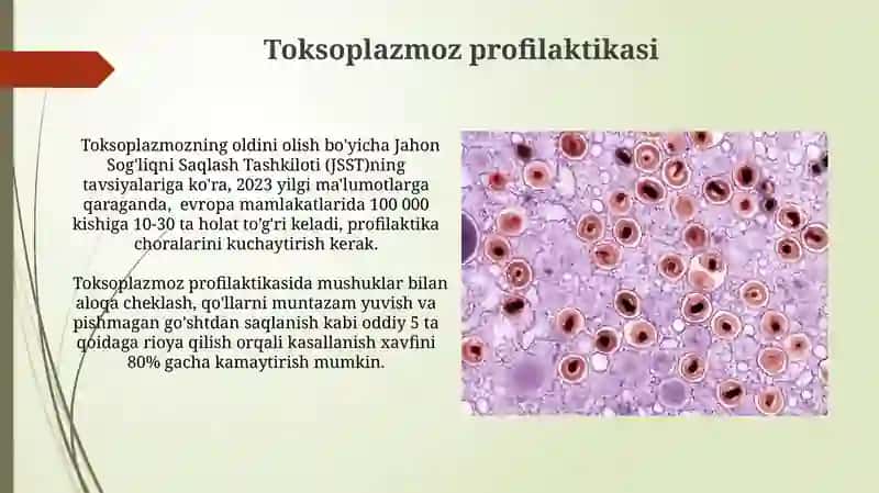 Toksoplazmoz kasalligini qo’zg’ovchisi 4