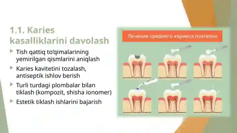 Terapevtik stomatologiya bo‘limini tashkil etish 4