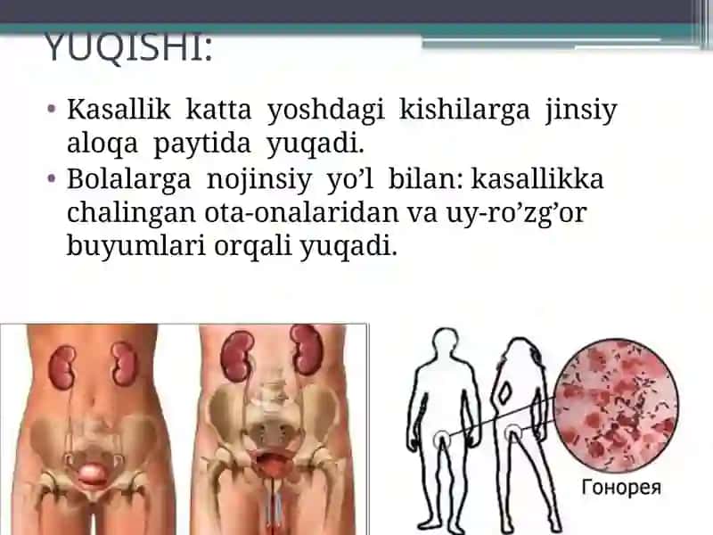 Siydiktanosila’zolarining nospetsifik infeksiya 4