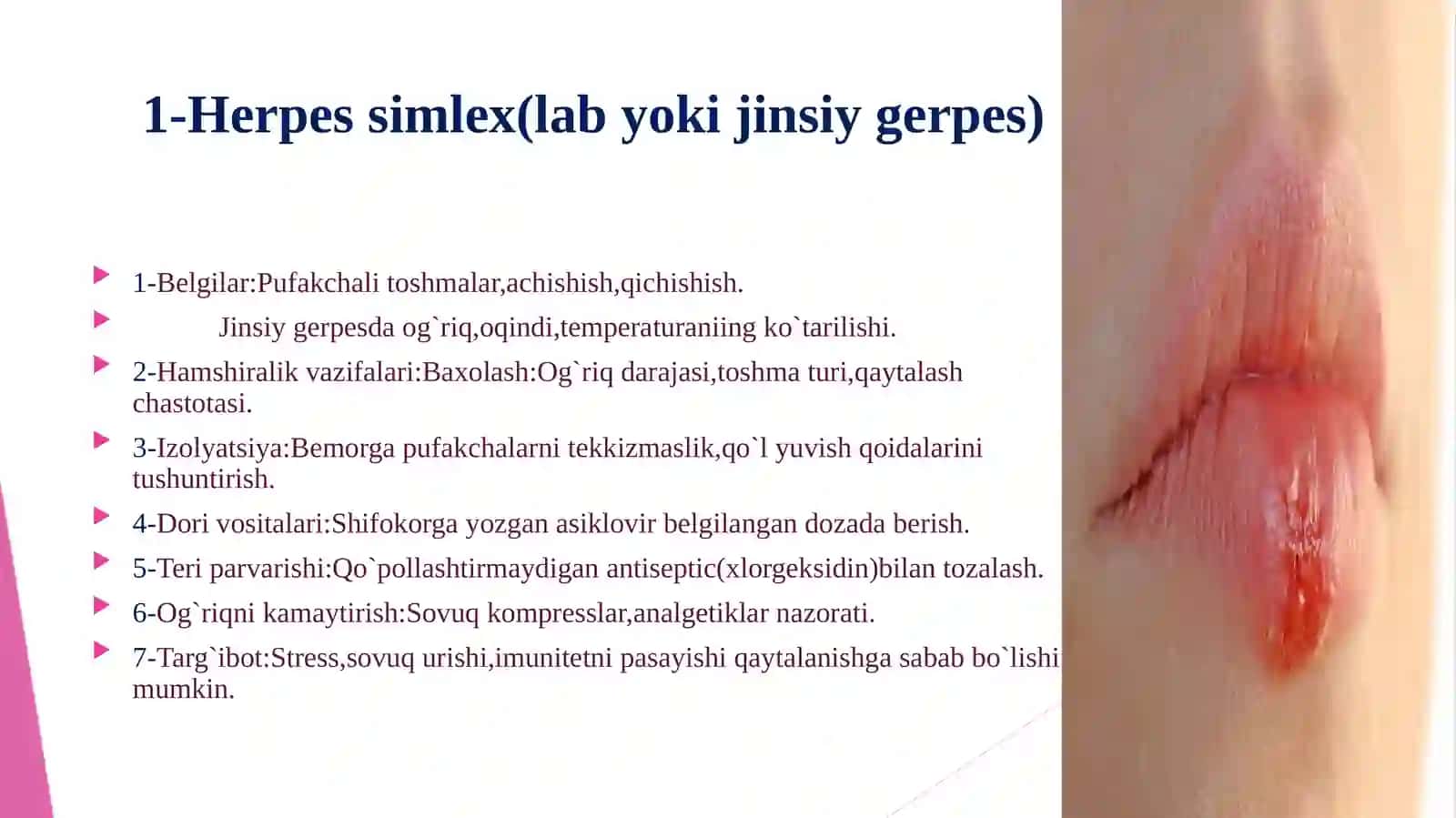 Viruslik kassaliklar 4