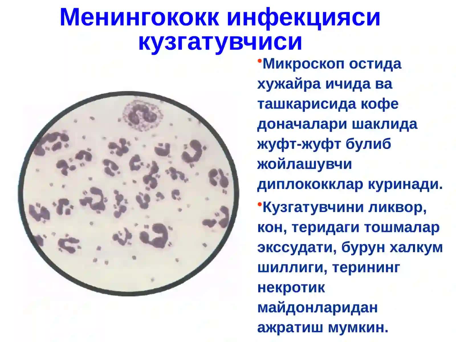 Менингококк инфекцияси 4