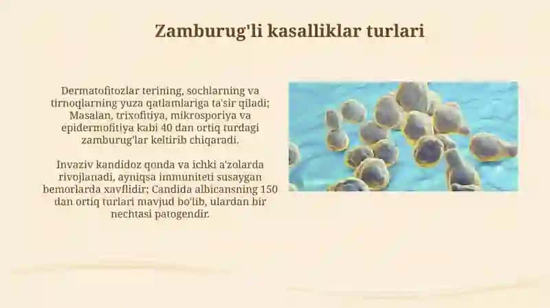 Zamburug'li kasalliklar 4