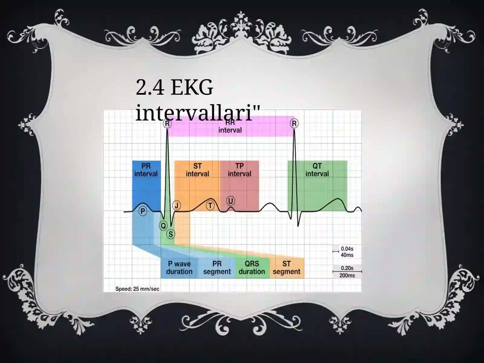 Yangi tug’ilgan chaqaloqlarda EKGni o’ziga xos xususiyatlari 4