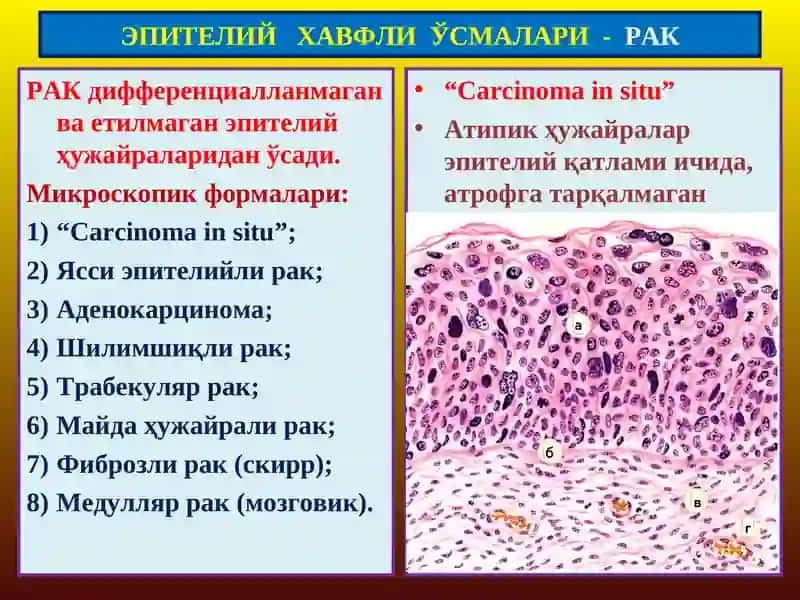 ЭПИТЕЛИЙ ХАВФСИЗЎСМАЛАРИ 4