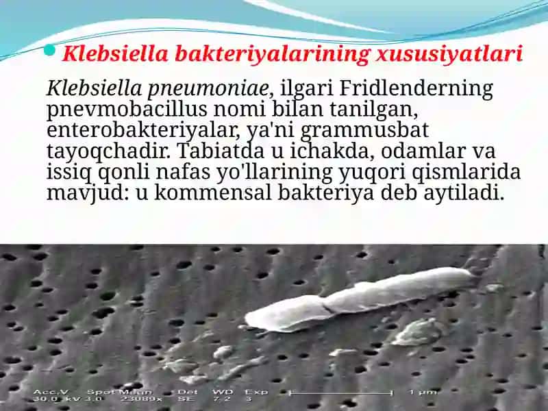 Shartli patogen dioreogen ichak gruppa bakteriyalari 4