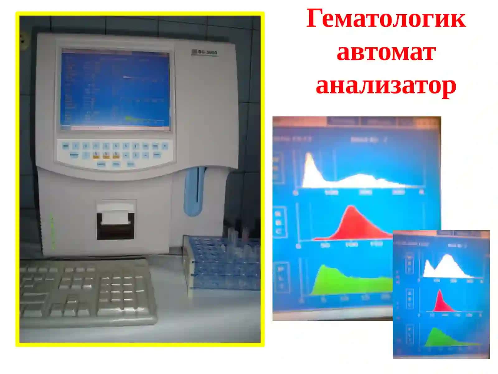 Қон клиник таҳлили ва унинг диагностик аҳамияти 4