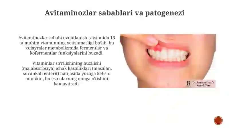 Nasliy avitaminozlar 4