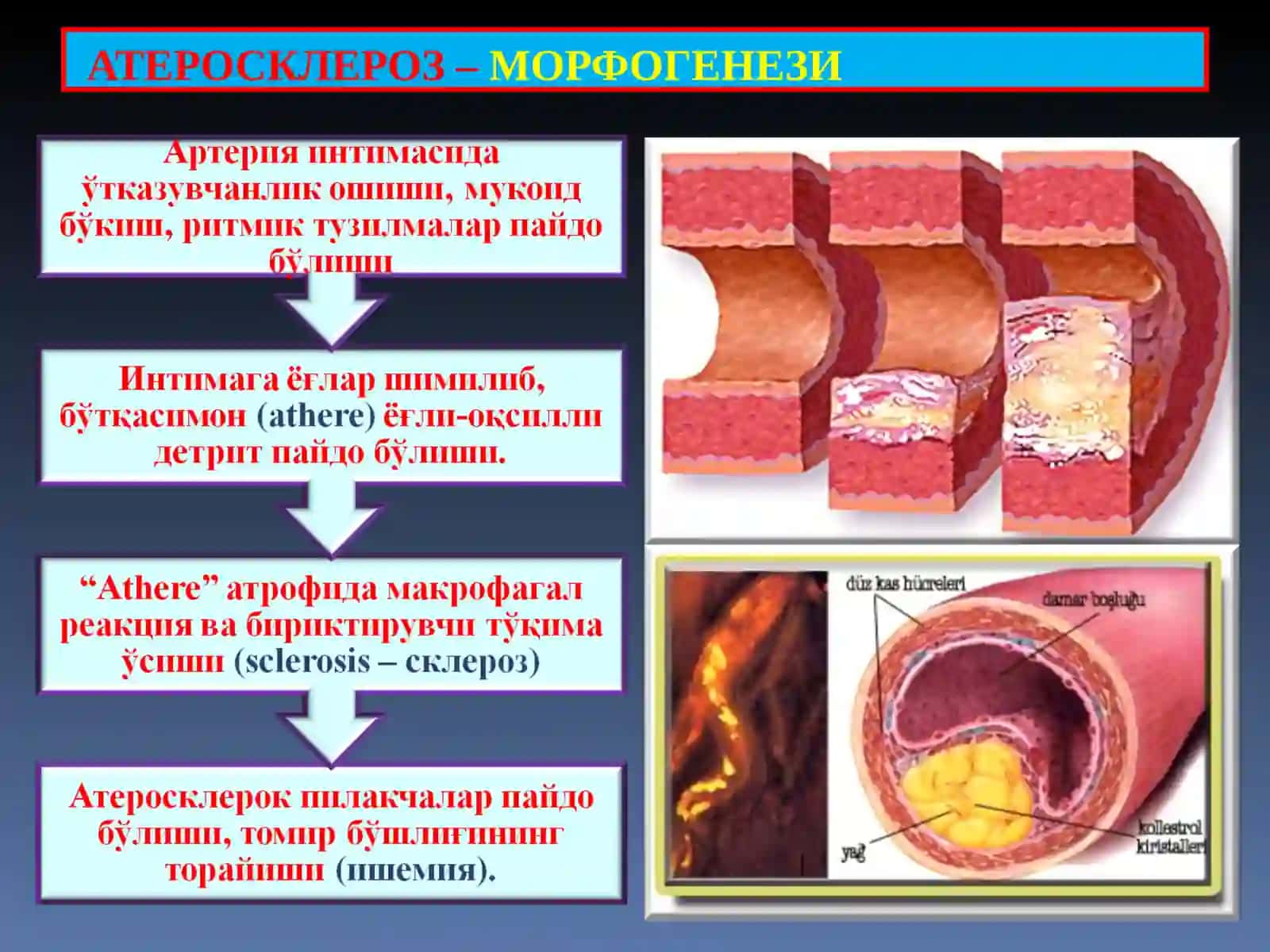 ПАТОЛОГИК АНАТОМИЯ 4