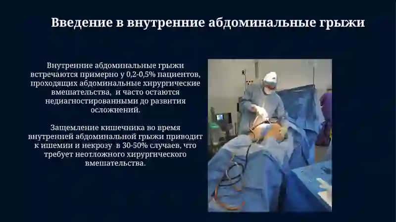 Внутренние грыжи живота. Спайки брюшины 4