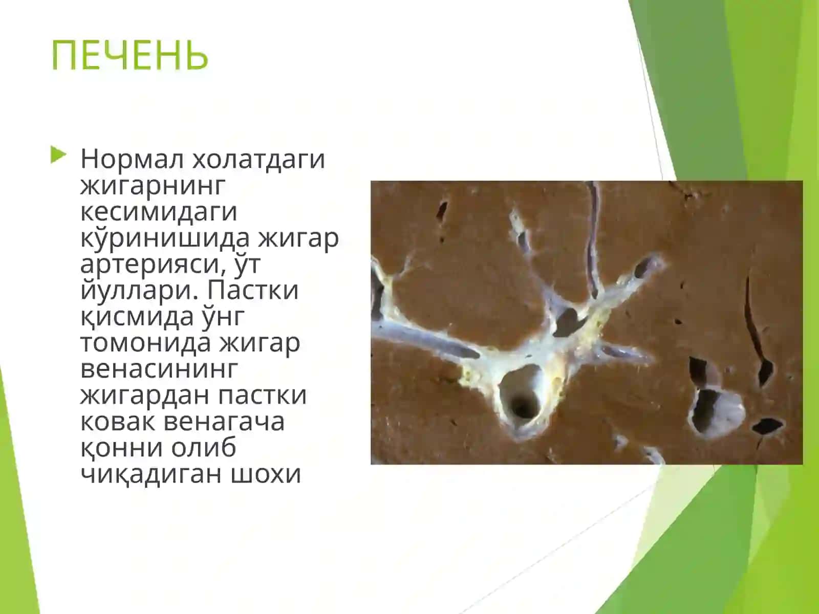 ПАТОЛОГИК АНАТОМИЯ 4