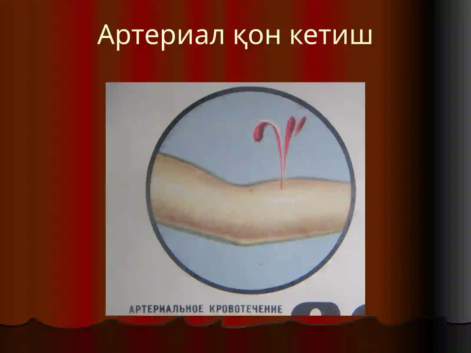 Қон кетиш ва уни тўхтатиш усуллари 4