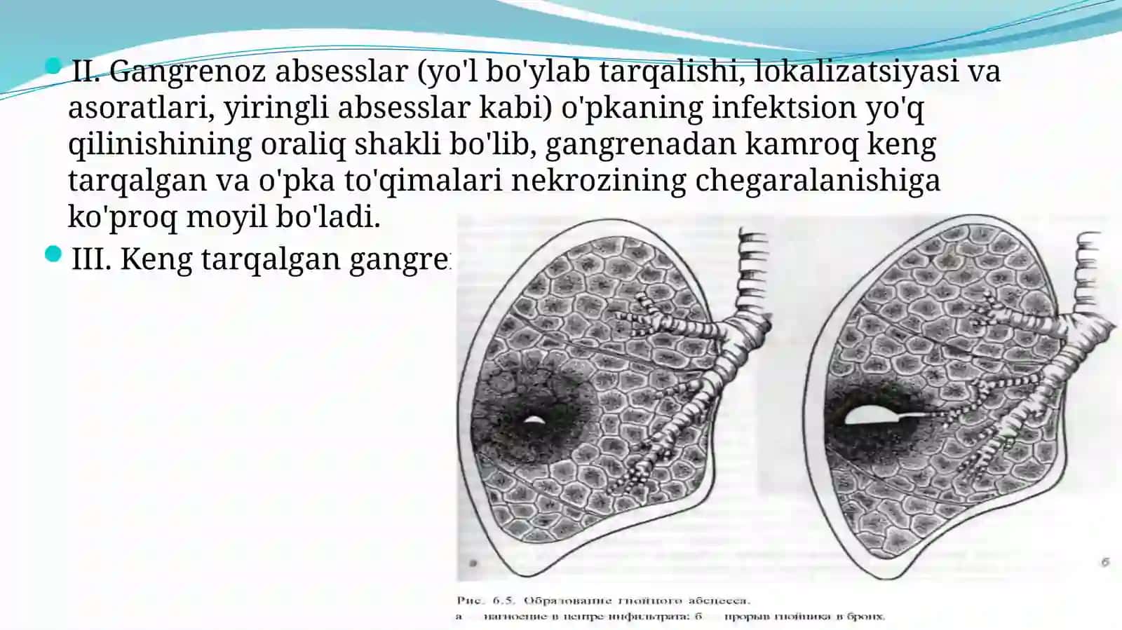 O’PKA ABSESSI VA GANGRENASI 4