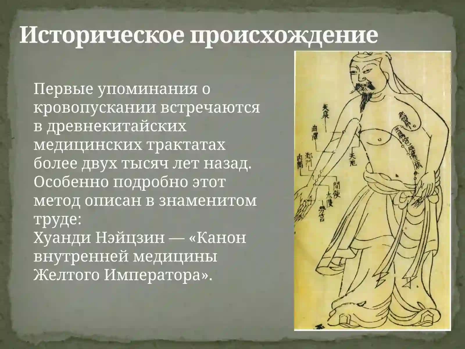 Лечение методом кровопускания в Древнем Китае 4