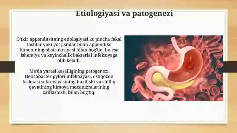 Qorin bo'shlig'i kasalliklari 4