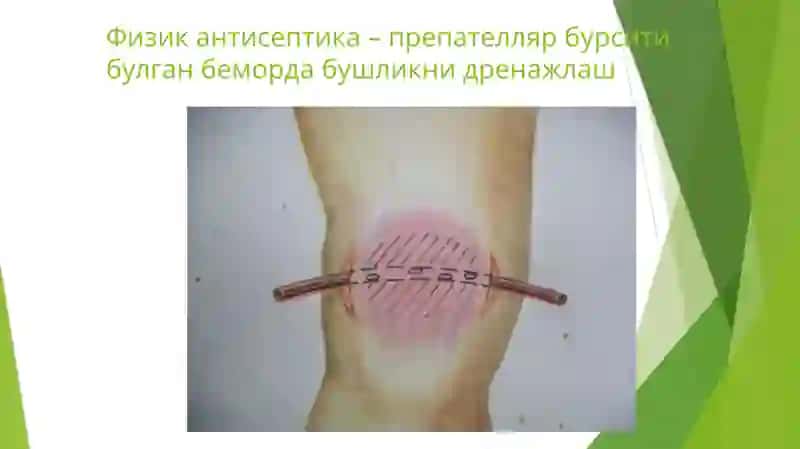 Zamonaviy Fizik Antiseptika 4
