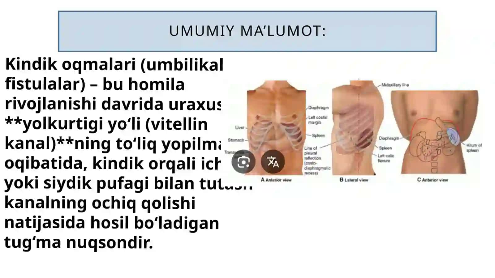 Kindikoqmalari 4