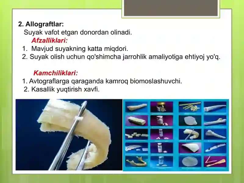 Transplantatlar(suyak transplantatlari) 4