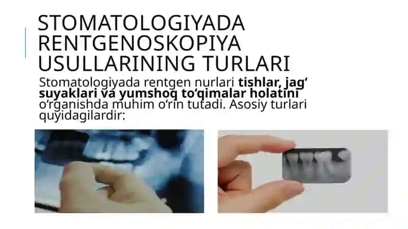 Rentgenoskopiyaning stomatologiyadagi o‘rni 4