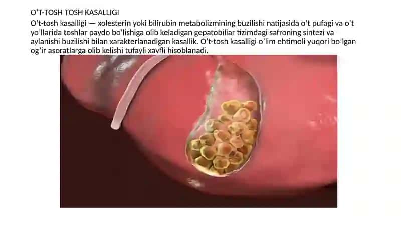 Tosh kasalliklarining kimyoviy xossalari 4