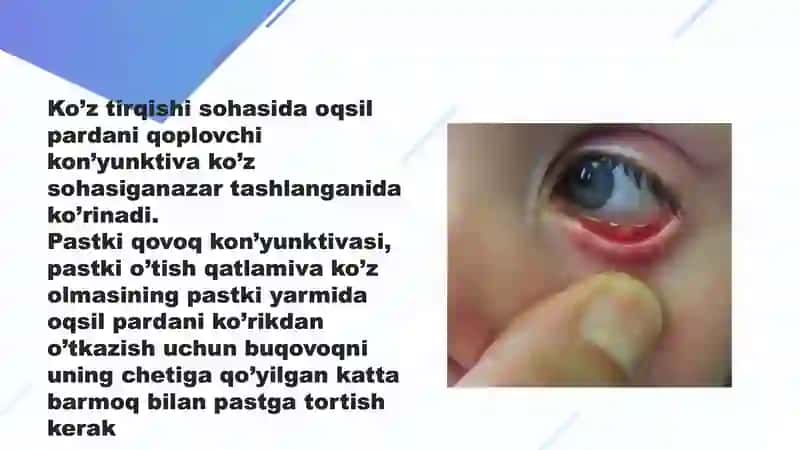 Qovoqlar ko’rikdan o’tkazish 4
