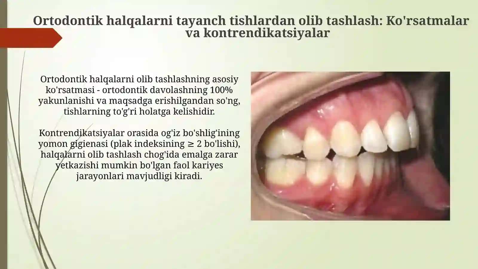 Ortodontik halqalar va breketlar 4