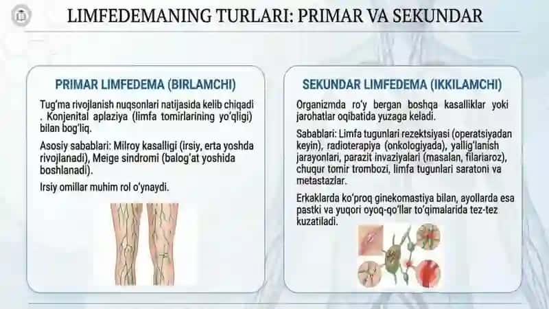 Limfa tomirlar patalogiyasi 4