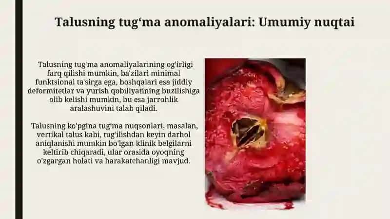 Taluqning tug'ma anomaliyalari va o'smalari 4