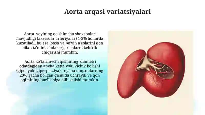 Aorta rivojlanishi va uning anatomik variantlari 4