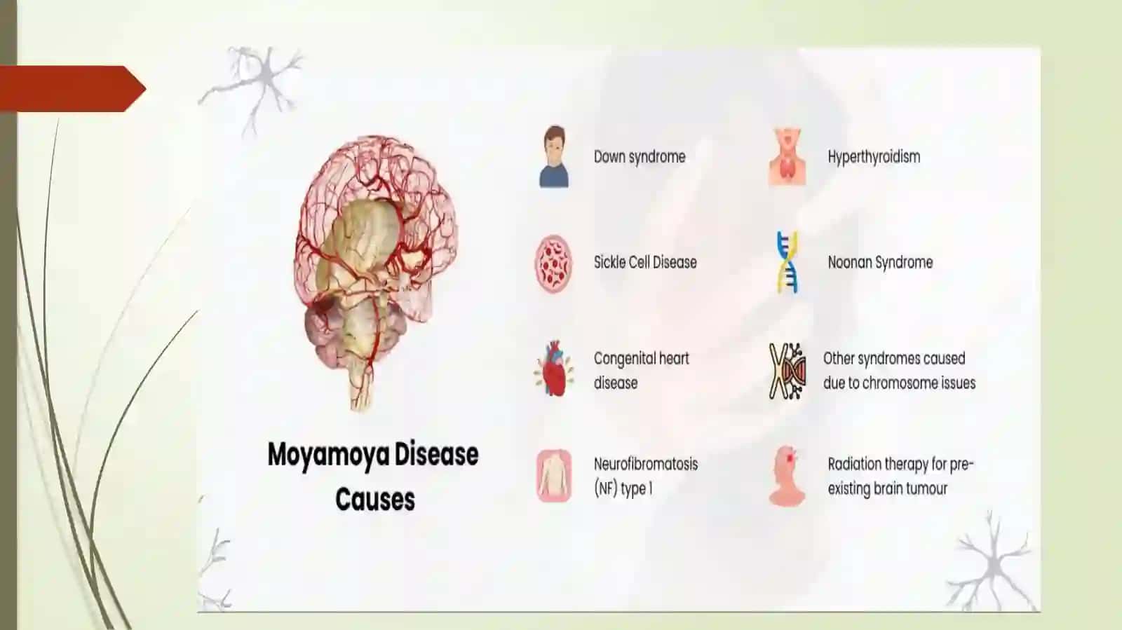 Moya-moyakasalligi 4