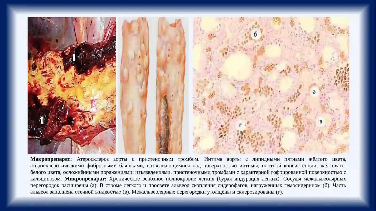 Макро и микропрепараты 4