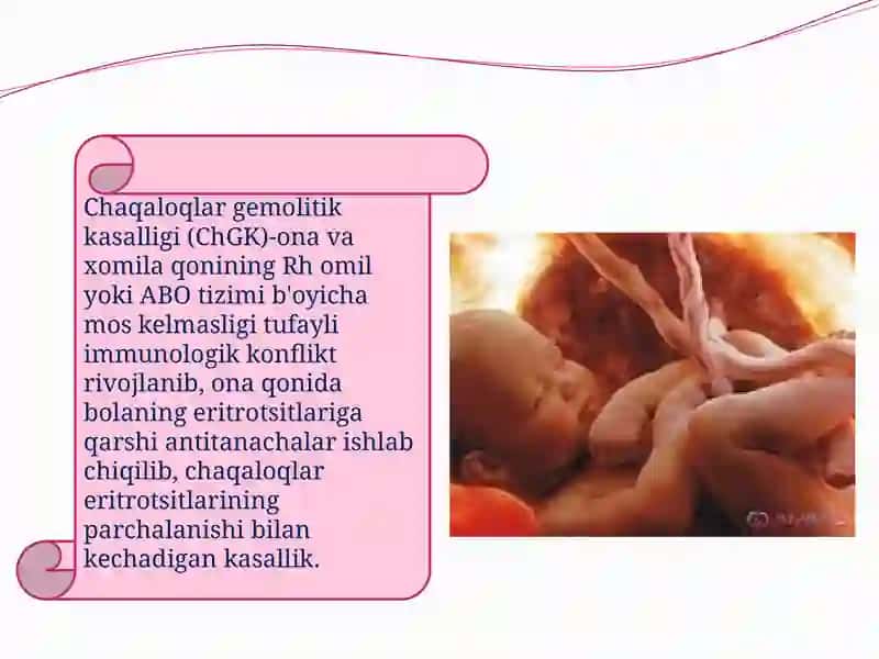 Chaqaloqlar gemolitik kasalligi 4
