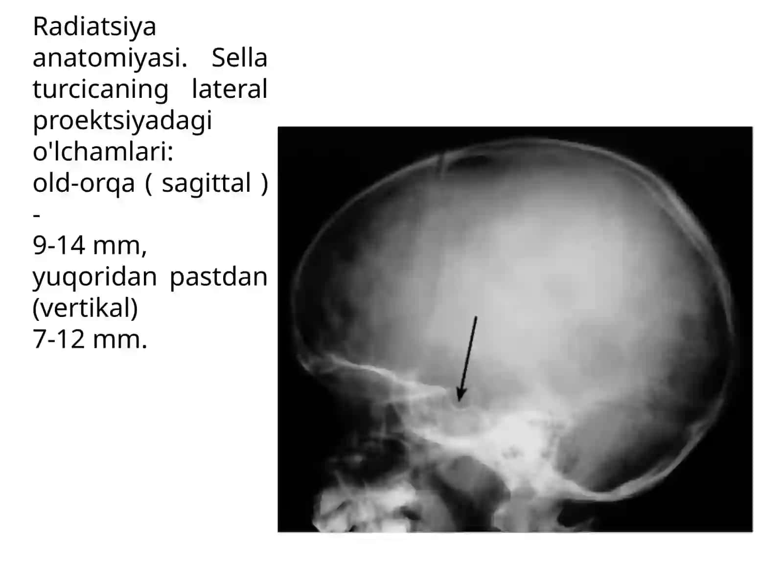 ENDOKRIN TIZIM KASALLIKLARINI RADIASYON DIAGNOSTIKASI 4