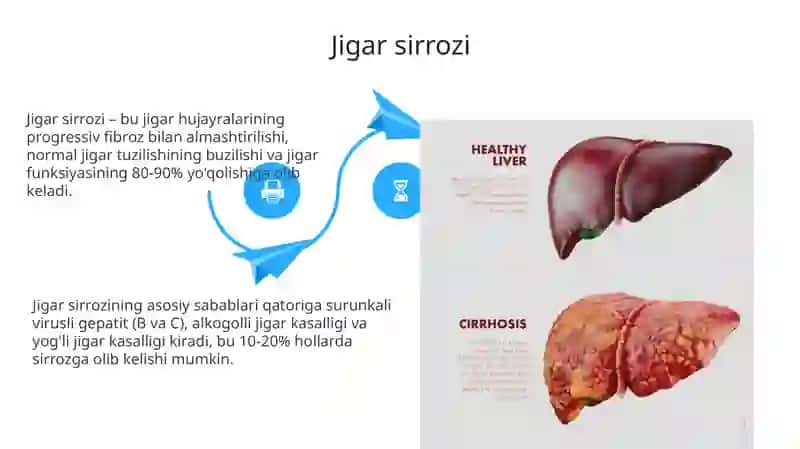 Gepatomegaliya, Jigar sirrozi va Sariqlik 4