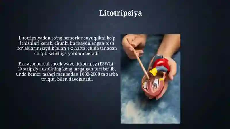 Buyrak tosh kasalliklari va davolash usullari 4