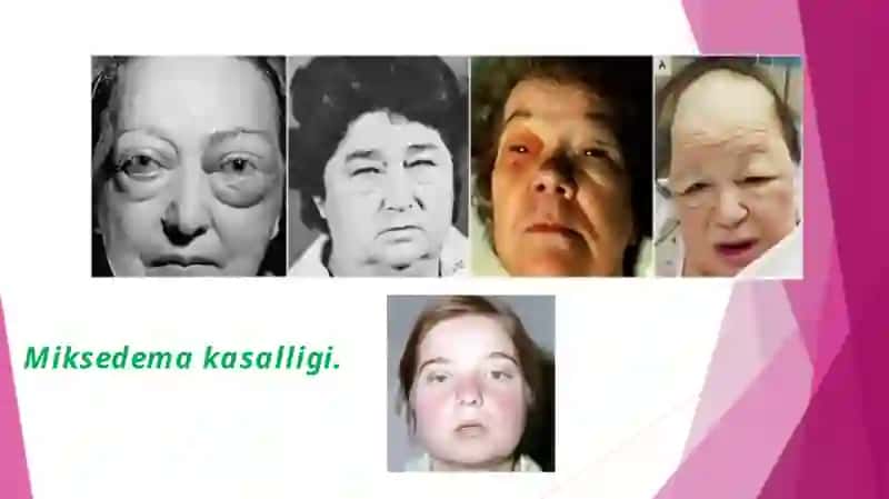 Sekretsiyabezlarito‘g‘risidatushuncha 4