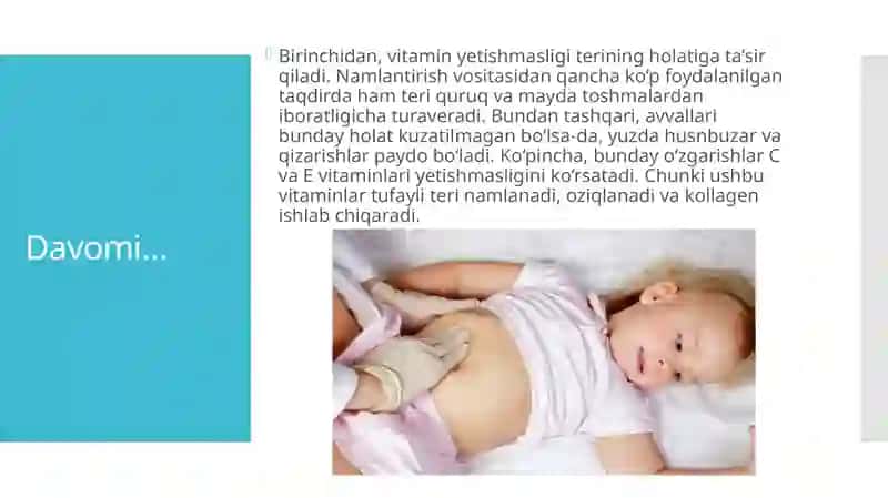 Gipovitaminoz 4