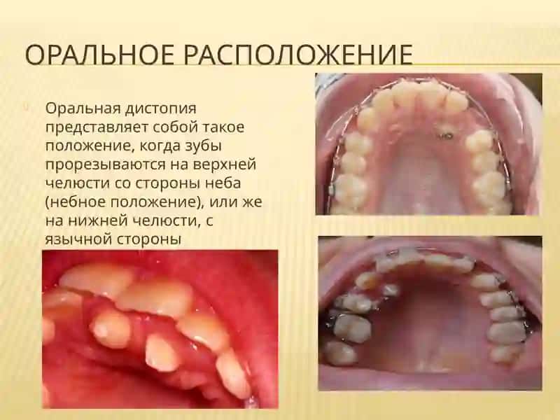 Дистопия клыка 4