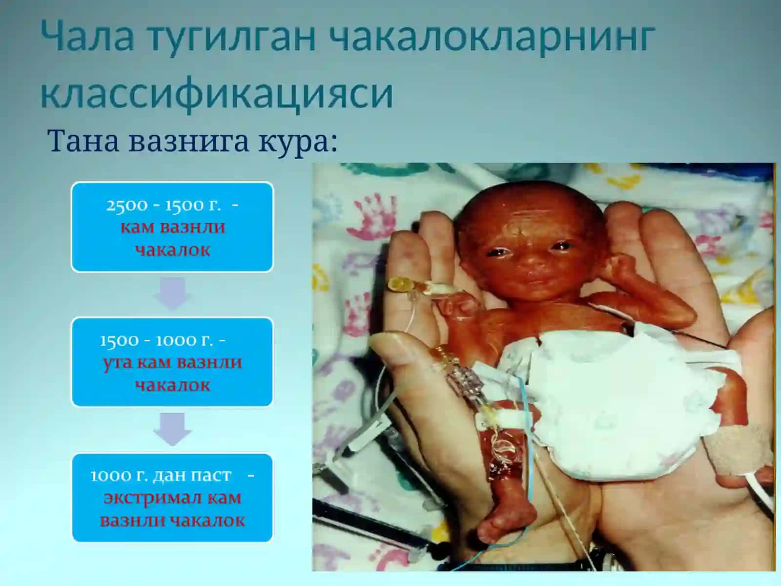 Чала тугилган чакалоклар 4