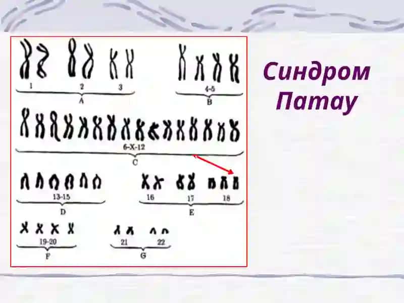 Пре- и перинатальная патология 4