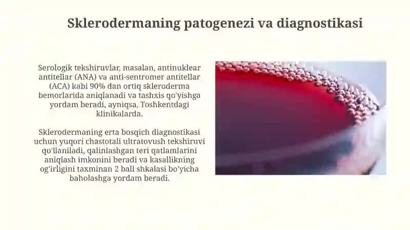Kollagenozlar patogenezi va diagnostikasi 4