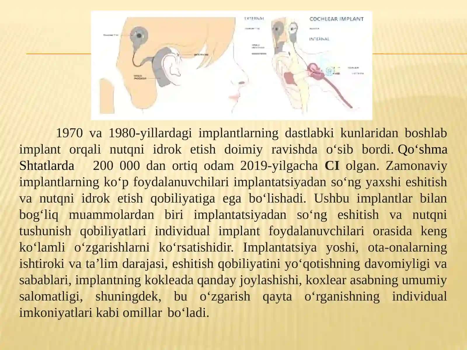 Kohlear implantant 4