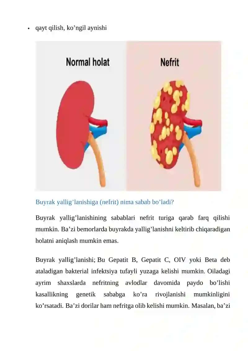 NEFRIT (BUYRAK YALLIG’LANISHI KASALLIGI) 4