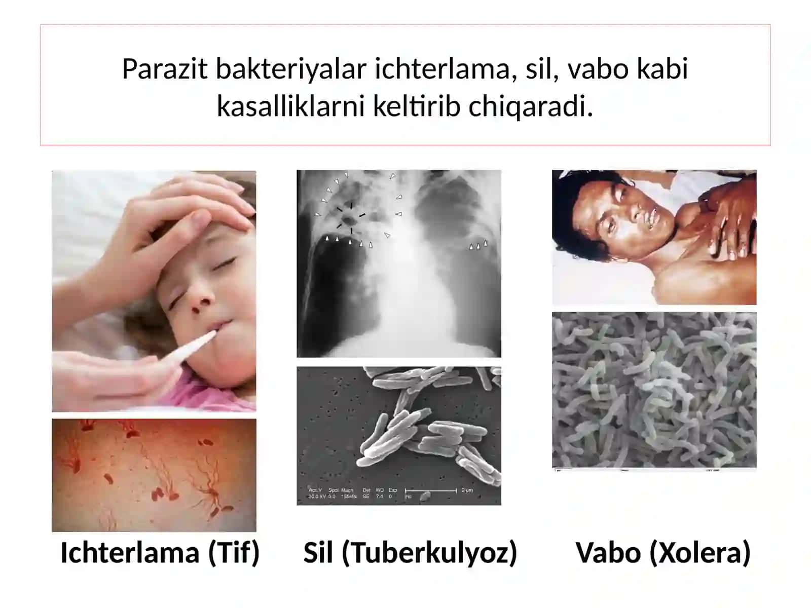 Yuqumli kasalliklar 4