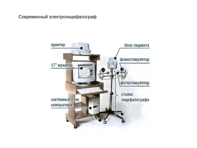Электроэнцефалография 4