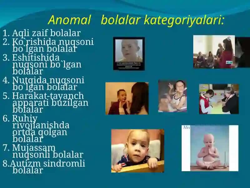 Anomal bolalar 4