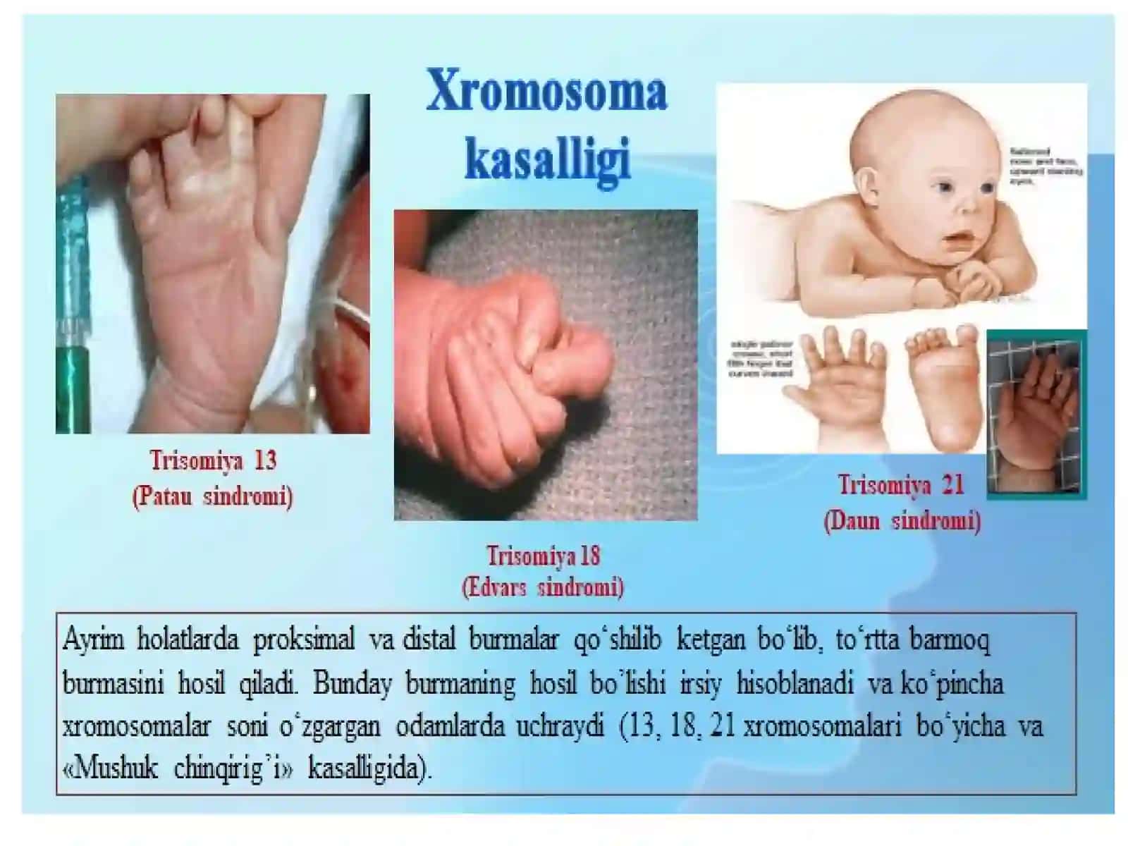 Sitogenetik va populyatsion statistik usul 4