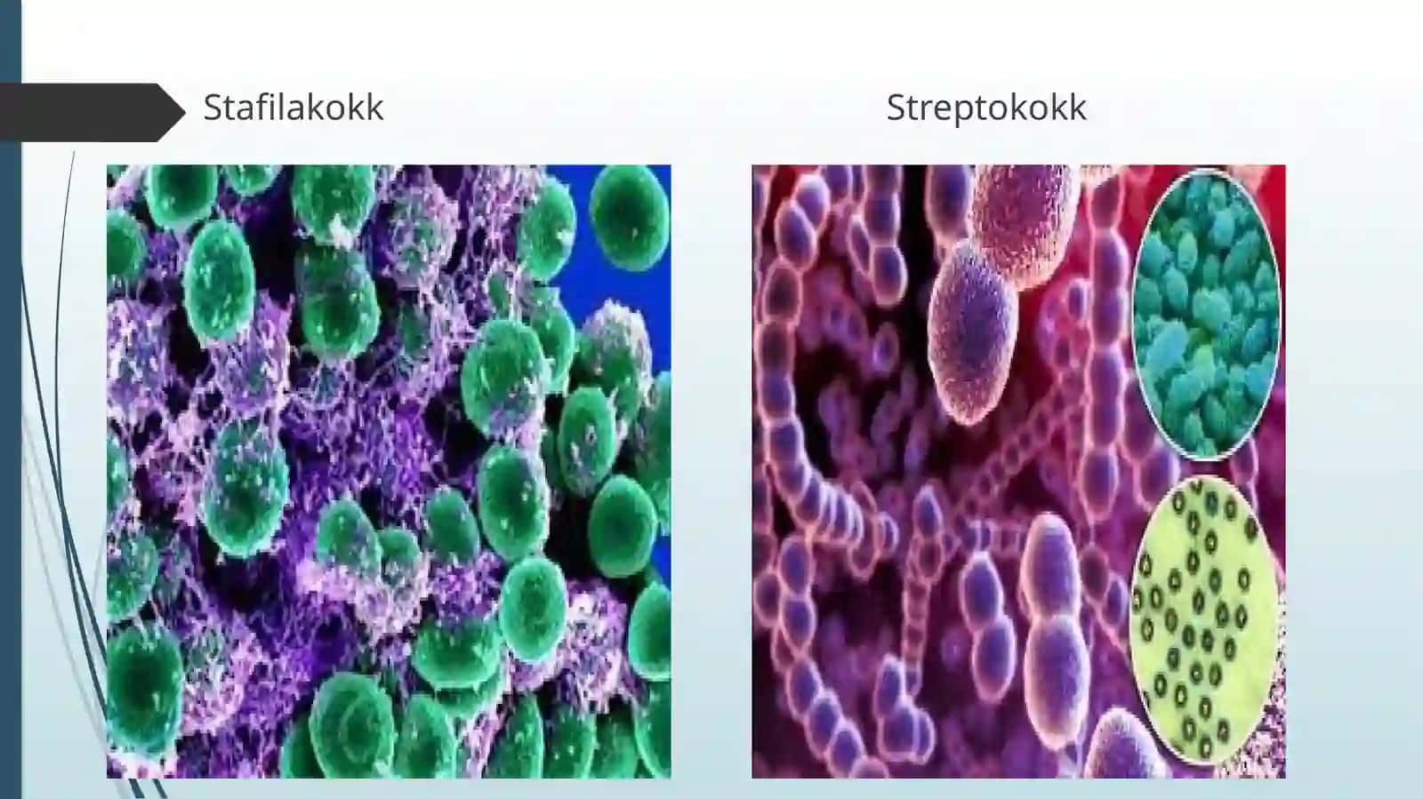 Sepsis-nospesifikiyiringli infeksiya turlari 4