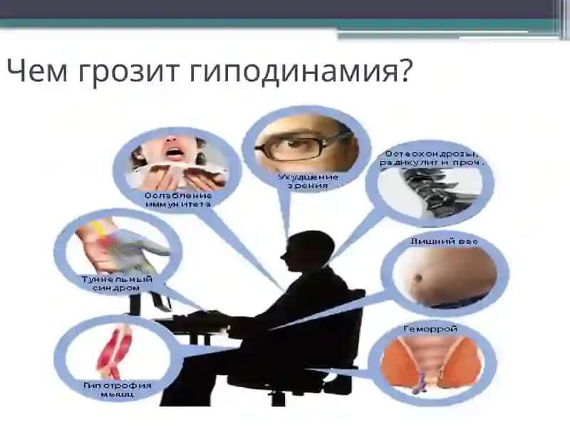 Гипидинамия основная критерия ожирения 4