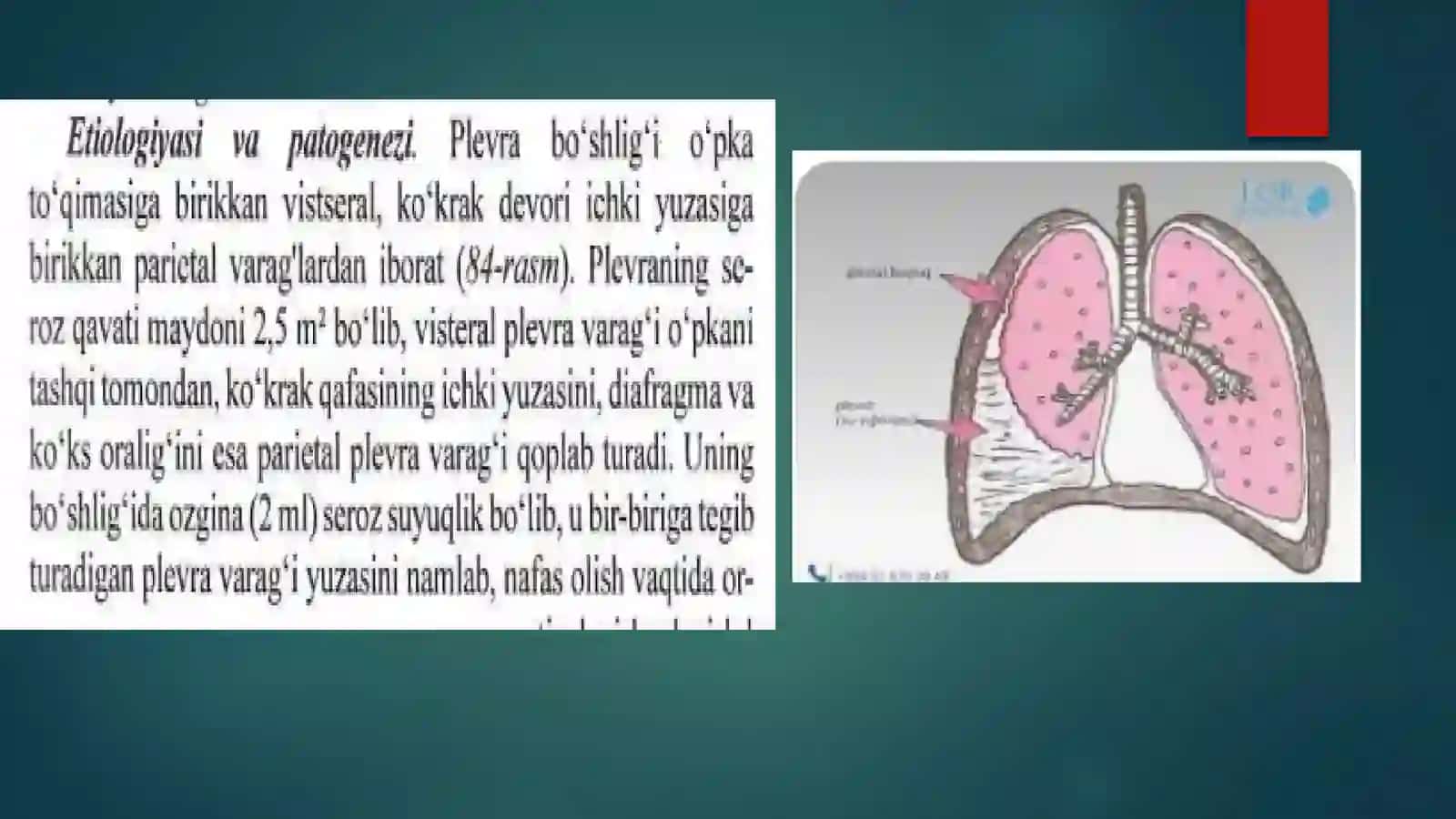 Ekssudativ plevrit 4