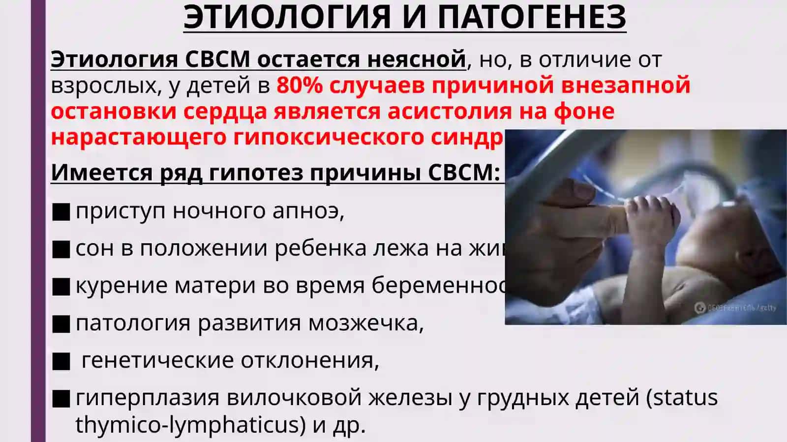 внезапныйсмертьноворожденных 4